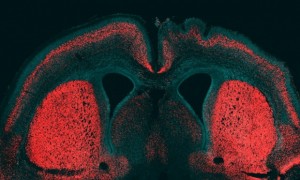 Mouse cerebral cortex (above): mouse embryos injected with the gene identified by scientist as key to human cognitive faculties grew larger brain regions and some developed the crinkled brain surface that humans have.  Credit: Marta Florio and Wieland B. Huttner, Max Planck Institute of Molecular Cell Biology and Genetics 