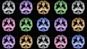 MRI image of happy brains