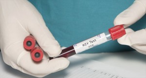 HIV blood test