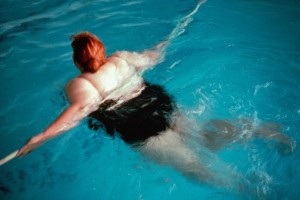 An obese woman swims in a swimming pool. Doctors say that the incidence of NASH has exploded in the last two decades thanks in part to the growing prevalence of obesity; though there are currently no medicines on the market to combat the disease (an opportunity several pharmaceutical companies hope to capitalize on), exercise and weight loss represents one of the most reliable ways to reverse the progression of the disease. Credit: Phanie/Alamy