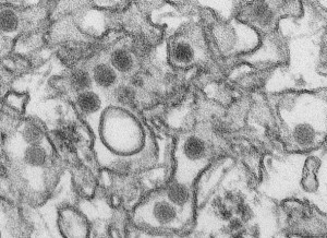 A transmission electron micrograph (TEM) shows the Zika virus, in an undated photo provided by the Centers For Disease Control in Atlanta, Georgia. Credit: Reuters/CDC/Cynthia Goldsmith